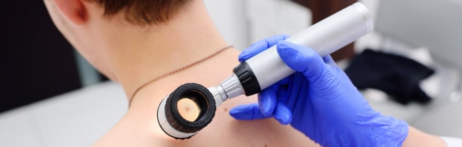 A gloved hand holding a dermatoscope to the upper back and shoulder of a man during a skin check