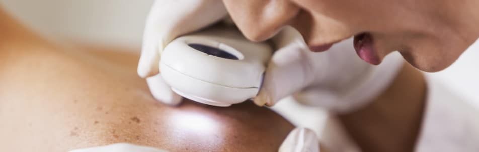 A gloved clinician examining a person's shoulder with a handheld dermatoscope