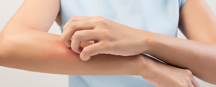 closeup image of person's arms showing them scratching at atopic dermatitis