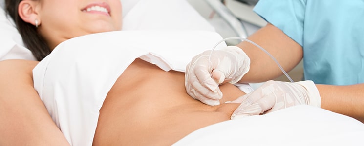 Tumescent Liposuction in Hollywood FL | Hollywood Dermatology