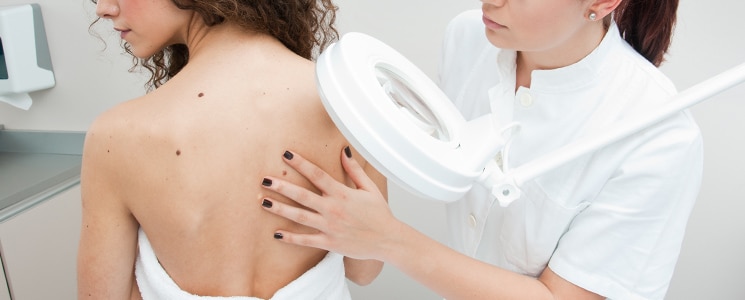 Doctor checking skin | Laser Birthmark Removal
