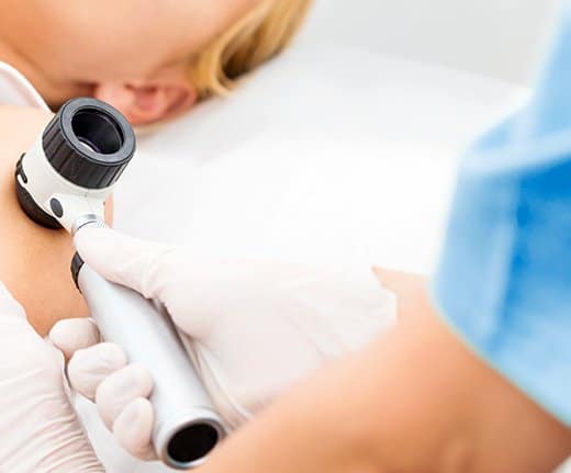 skin-cancer-treatment