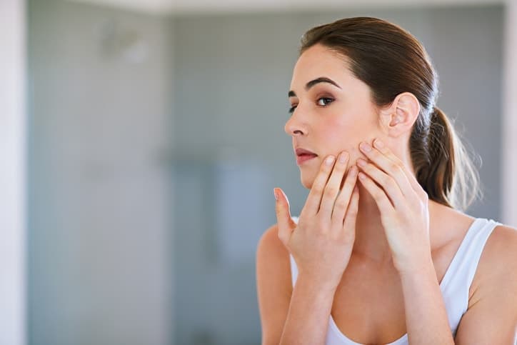 young female with acne