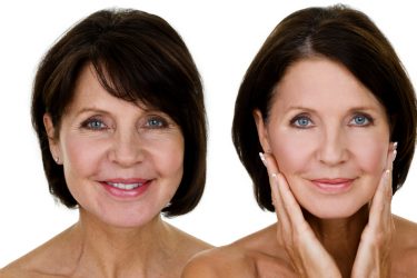 treatment before and after