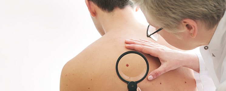 skin cancer treatments