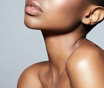 Kybella