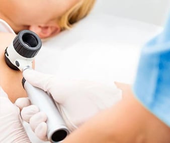 Skin Cancer Treatment