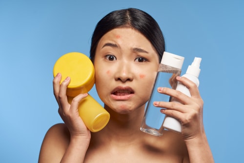 asian woman holding cream jars for acne problems