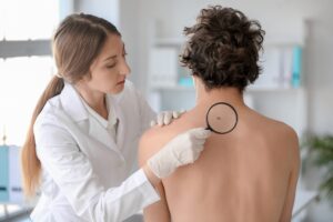 Dermatologist examining mole on man's back with magnifying glass