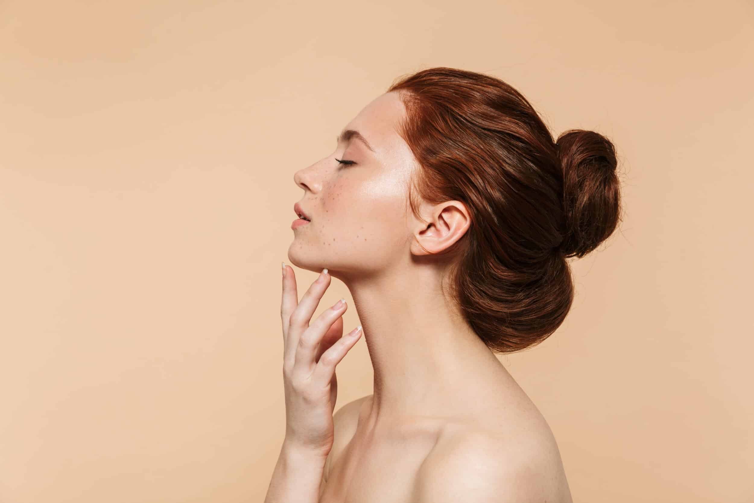 A profile shot of a woman after a CO2 laser treatment in South Florida